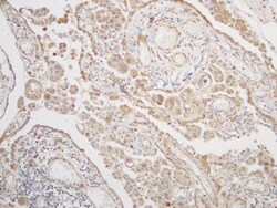 BAG3 Antibody, Novus Biologicals 0.1mL; Unlabeled:Antibodies, Polyclonal